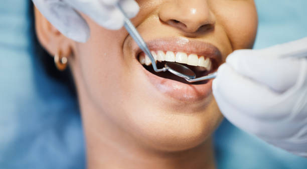 Best Emergency Treatment for Dental Infections or Abscesses in Ama, LA